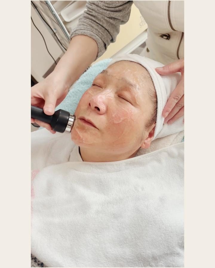 ソニックエステの施術